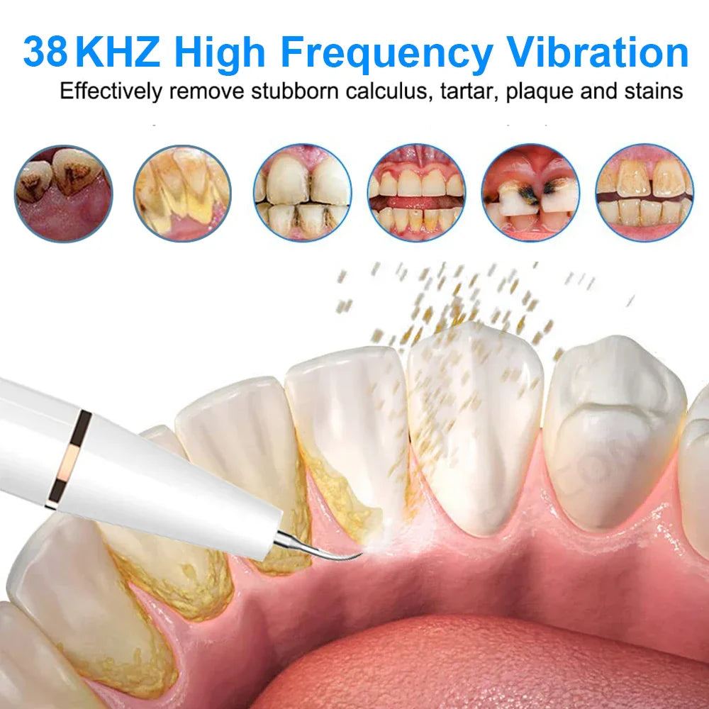 "Sleek women's ultrasonic tooth cleaner for plaque removal, featuring advanced design and technology for oral hygiene."