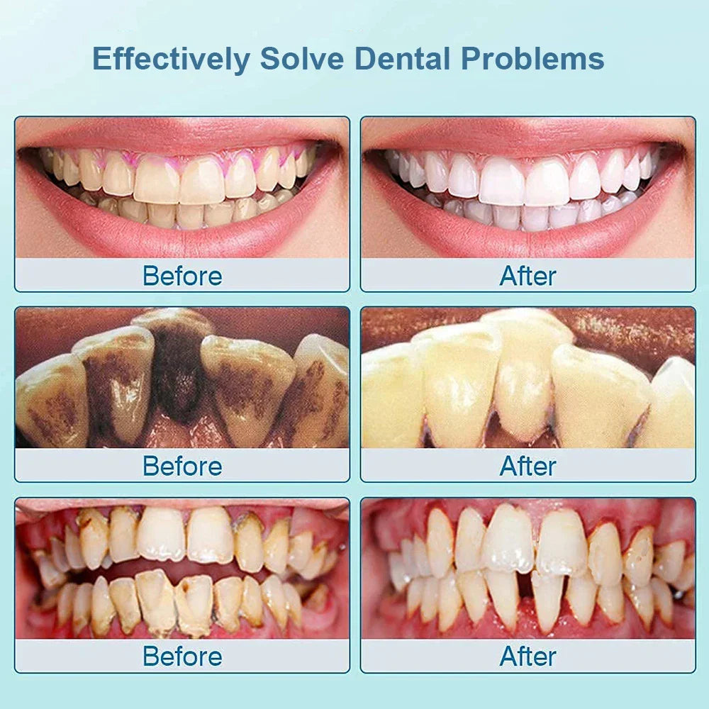 "Sleek women's ultrasonic tooth cleaner for plaque removal, featuring advanced design and technology for oral hygiene."